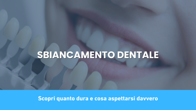 sbiancamento dentale quanto dura