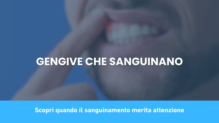 gengive che sanguinano