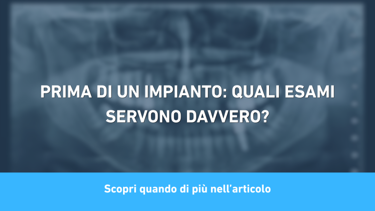 Prima di un impianto: quali esami servono davvero?