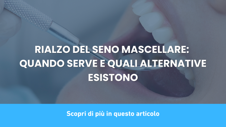 RIALZO DEL SENO MASCELLARE: QUANDO SERVE E QUALI ALTERNATIVE ESISTONO