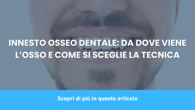 INNESTO OSSEO DENTALE: DA DOVE VIENE L’OSSO E COME SI SCEGLIE LA TECNICA