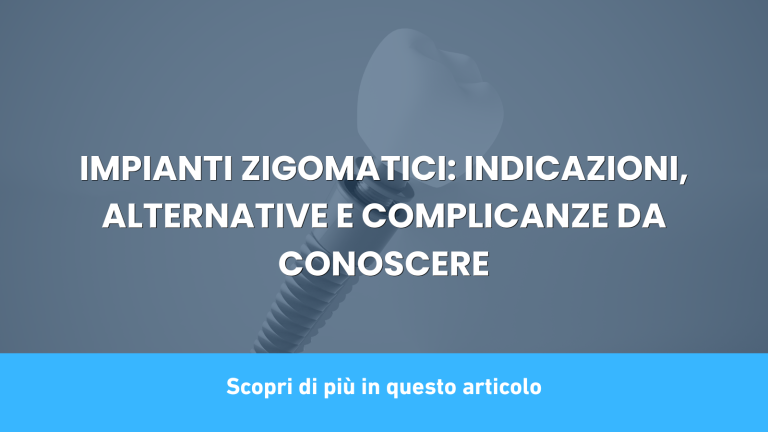 IMPIANTI ZIGOMATICI: INDICAZIONI, ALTERNATIVE E COMPLICANZE DA CONOSCERE