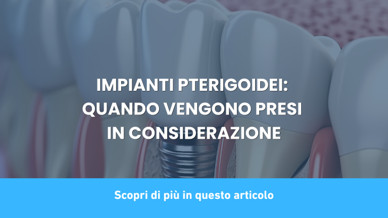 IMPIANTI PTERIGOIDEI: QUANDO VENGONO PRESI IN CONSIDERAZIONE