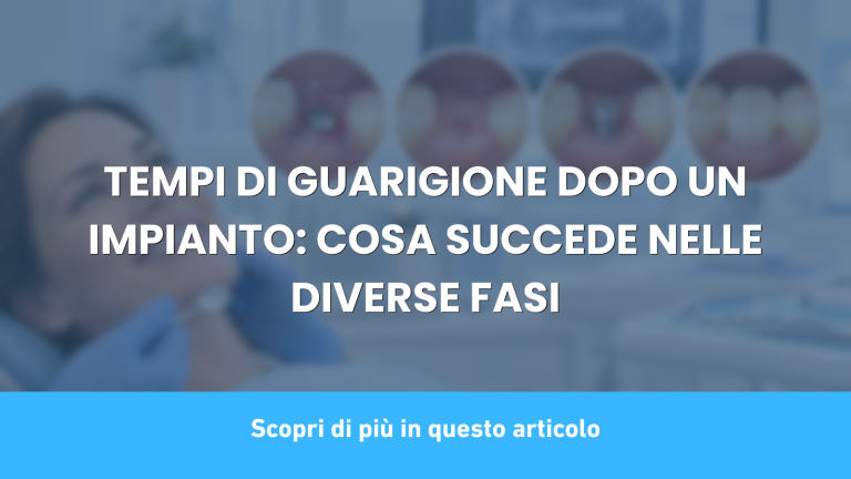 TEMPI DI GUARIGIONE DOPO UN IMPIANTO: COSA SUCCEDE NELLE DIVERSE FASI