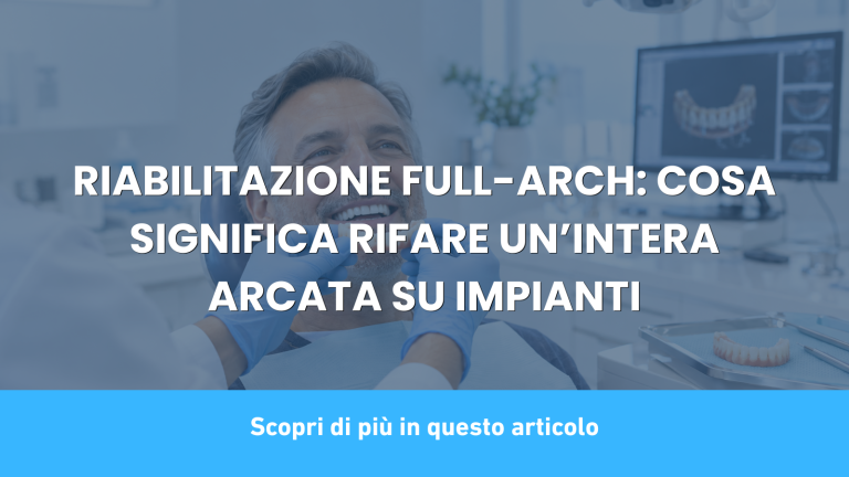 RIABILITAZIONE FULL-ARCH: COSA SIGNIFICA RIFARE UN’INTERA ARCATA SU IMPIANTI